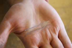 An open metal stent in an open hand